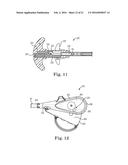 SUTURE ASSEMBLY INCLUDING A SUTURE CLIP diagram and image