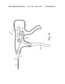 SUTURE ASSEMBLY INCLUDING A SUTURE CLIP diagram and image