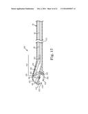 SUTURE ASSEMBLY INCLUDING A SUTURE CLIP diagram and image