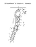 SUTURE ASSEMBLY INCLUDING A SUTURE CLIP diagram and image