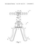 SURGICAL INSTRUMENT FOR IMPLANTING FIXATION DEVICE diagram and image