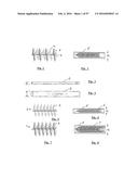 EMBOLISATION SYSTEMS diagram and image