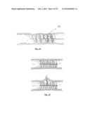 EMBOLISATION SYSTEMS diagram and image