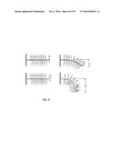 EMBOLISATION SYSTEMS diagram and image