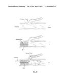 EMBOLISATION SYSTEMS diagram and image