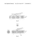 EMBOLISATION SYSTEMS diagram and image