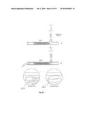 EMBOLISATION SYSTEMS diagram and image