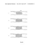 EMBOLISATION SYSTEMS diagram and image