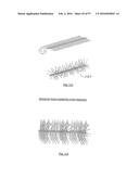 EMBOLISATION SYSTEMS diagram and image