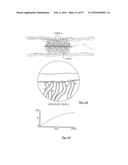 EMBOLISATION SYSTEMS diagram and image