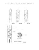 EMBOLISATION SYSTEMS diagram and image