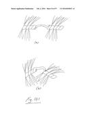 EMBOLISATION SYSTEMS diagram and image