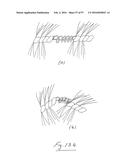 EMBOLISATION SYSTEMS diagram and image