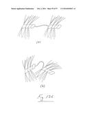 EMBOLISATION SYSTEMS diagram and image