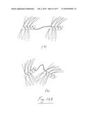 EMBOLISATION SYSTEMS diagram and image