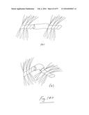 EMBOLISATION SYSTEMS diagram and image