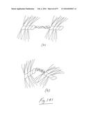 EMBOLISATION SYSTEMS diagram and image