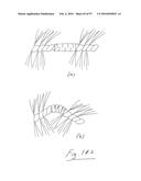 EMBOLISATION SYSTEMS diagram and image