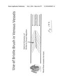 EMBOLISATION SYSTEMS diagram and image