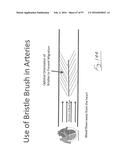 EMBOLISATION SYSTEMS diagram and image