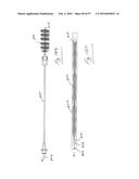 EMBOLISATION SYSTEMS diagram and image