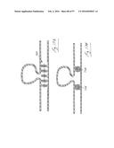 EMBOLISATION SYSTEMS diagram and image