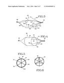 REMOVABLE LUNG REDUCTION DEVICES, SYSTEMS, AND METHODS diagram and image