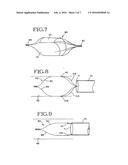 REMOVABLE LUNG REDUCTION DEVICES, SYSTEMS, AND METHODS diagram and image