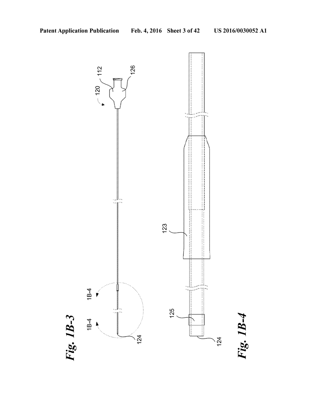 ENDOVASCULAR OCCLUSION DEVICE WITH HEMODYNAMICALLY ENHANCED SEALING AND     ANCHORING - diagram, schematic, and image 04