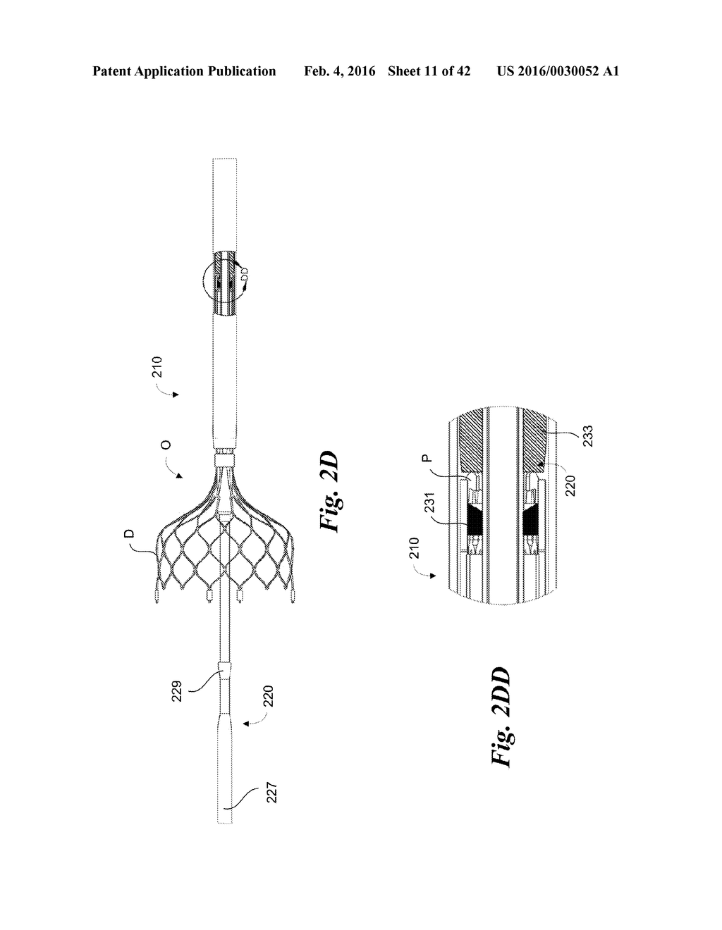 ENDOVASCULAR OCCLUSION DEVICE WITH HEMODYNAMICALLY ENHANCED SEALING AND     ANCHORING - diagram, schematic, and image 12