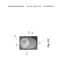 ENDOVASCULAR OCCLUSION DEVICE WITH HEMODYNAMICALLY ENHANCED SEALING AND     ANCHORING diagram and image