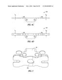 INSTRUMENTS AND METHODS IN PERFORMING KINEMATICALLY-ALIGNED TOTAL KNEE     ARTHROPLASTY diagram and image