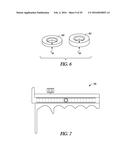 INSTRUMENTS AND METHODS IN PERFORMING KINEMATICALLY-ALIGNED TOTAL KNEE     ARTHROPLASTY diagram and image