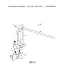 INSTRUMENTS AND METHODS IN PERFORMING KINEMATICALLY-ALIGNED TOTAL KNEE     ARTHROPLASTY diagram and image