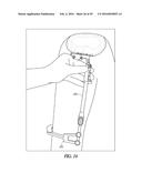 INSTRUMENTS AND METHODS IN PERFORMING KINEMATICALLY-ALIGNED TOTAL KNEE     ARTHROPLASTY diagram and image