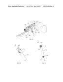 INTRAMEDULLARY NAIL FIXATION GUIDES, DEVICES AND METHODS OF USE diagram and image