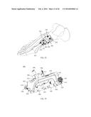 INTRAMEDULLARY NAIL FIXATION GUIDES, DEVICES AND METHODS OF USE diagram and image