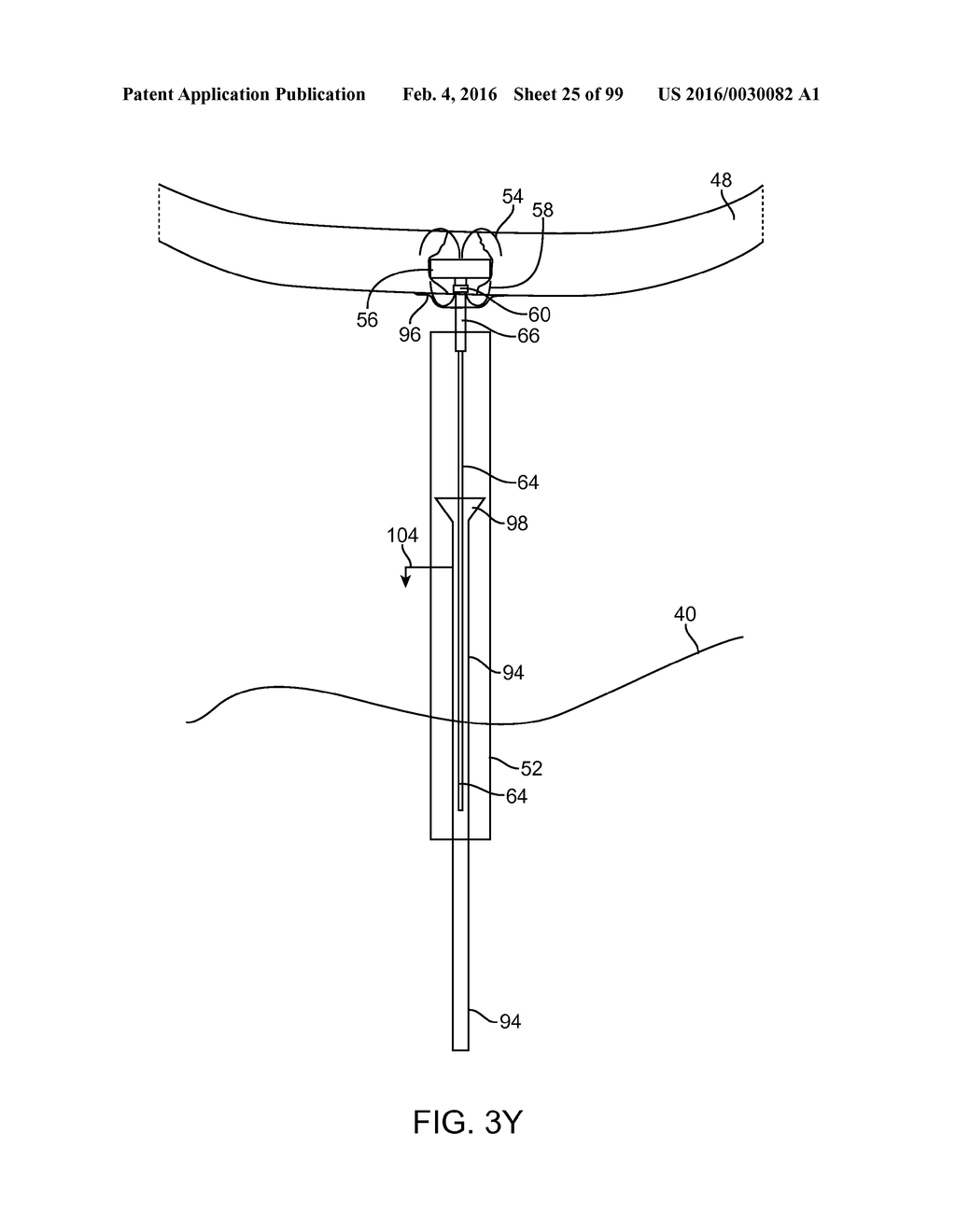 SYSTEM AND METHOD FOR TRANSAPICAL ACCESS AND CLOSURE - diagram, schematic, and image 26