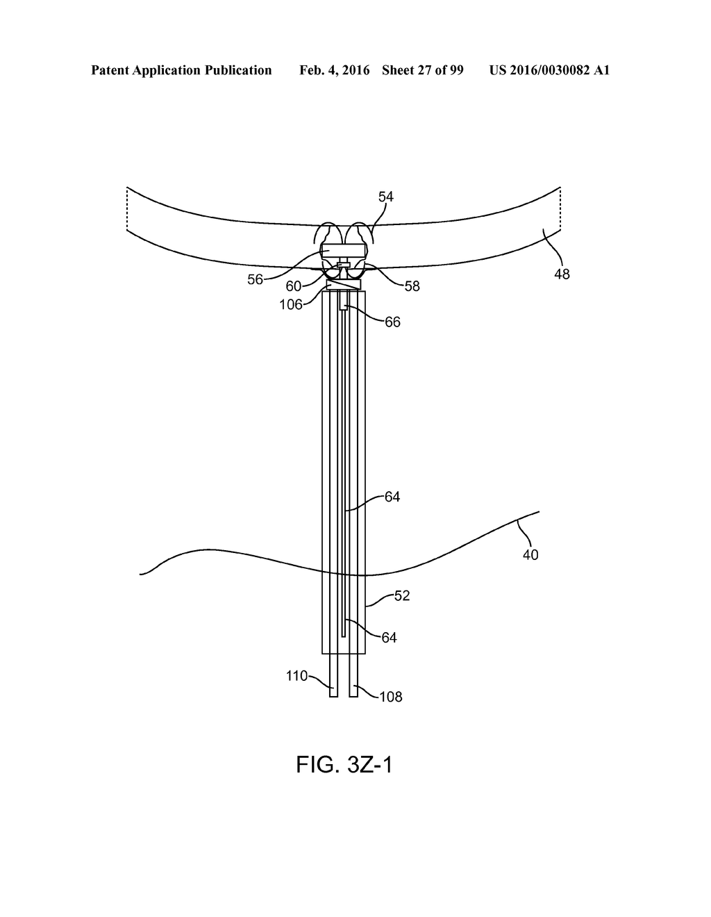 SYSTEM AND METHOD FOR TRANSAPICAL ACCESS AND CLOSURE - diagram, schematic, and image 28