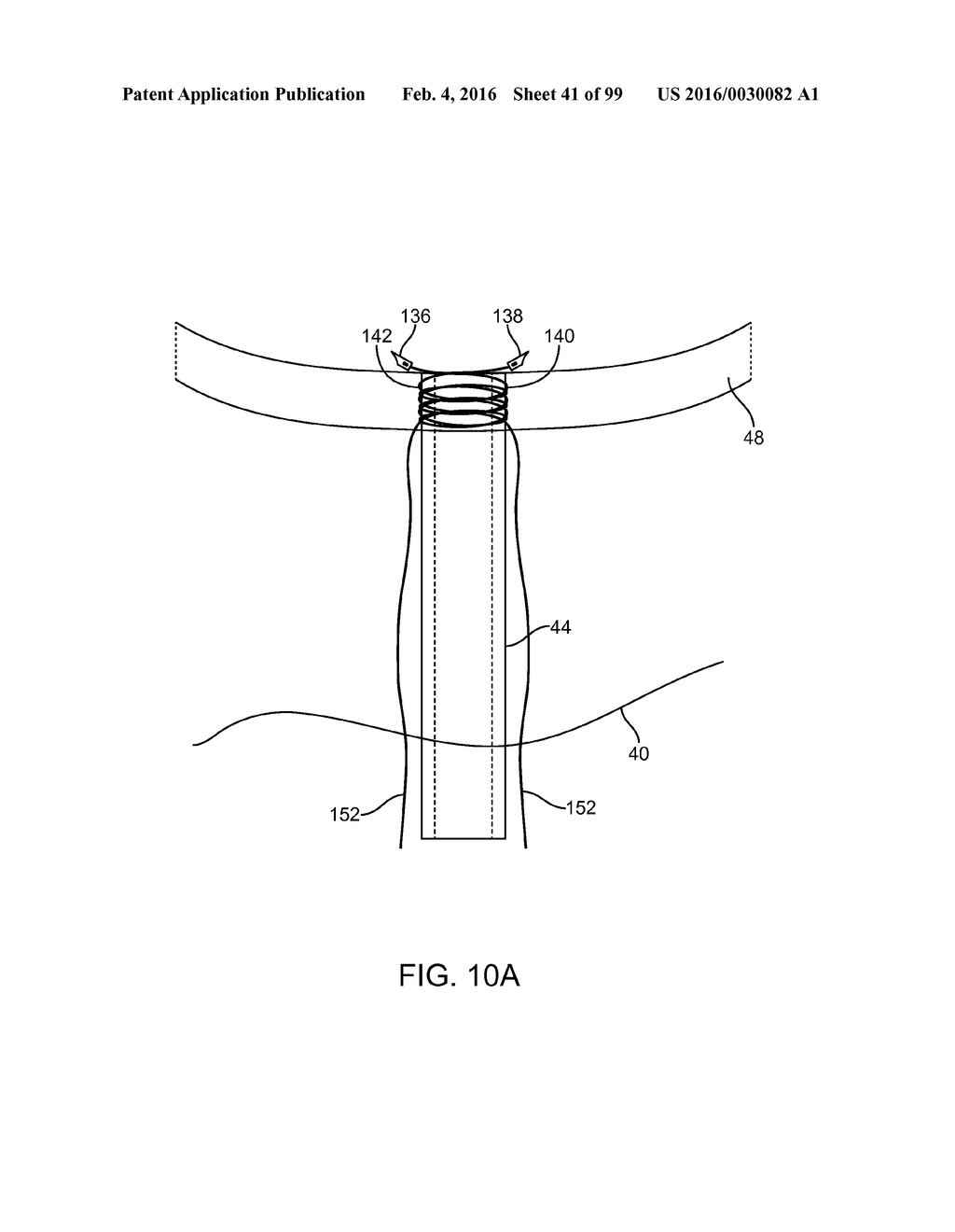 SYSTEM AND METHOD FOR TRANSAPICAL ACCESS AND CLOSURE - diagram, schematic, and image 42