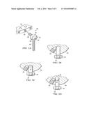 EXTERNAL FIXATOR STRUT diagram and image