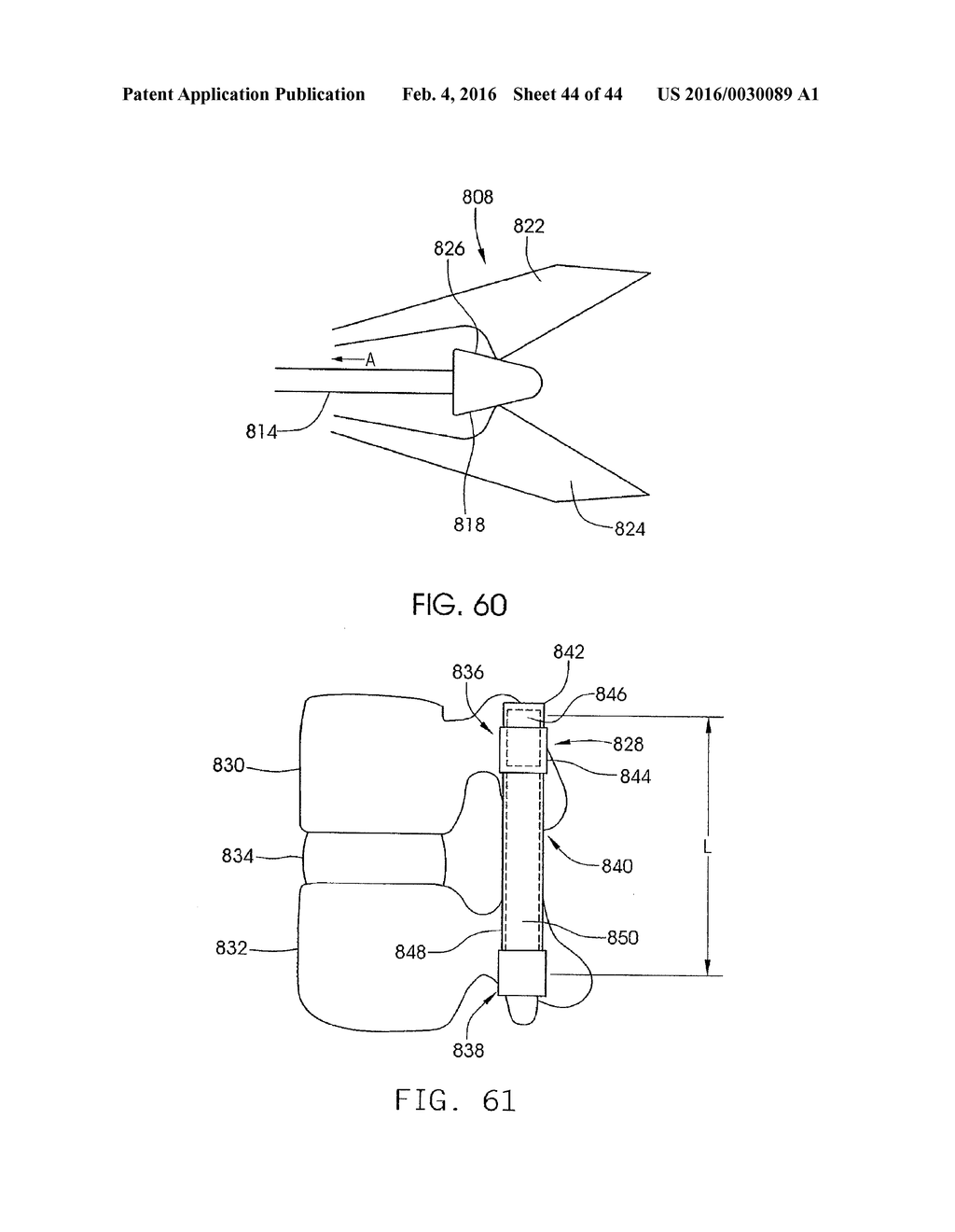 SKELETAL MANIPULATION METHOD - diagram, schematic, and image 45