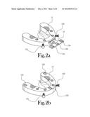 SURGICAL COMPONENT NAVIGATION SYSTEMS AND METHODS diagram and image