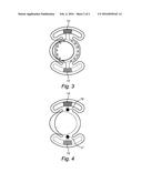 Intraocular Lens with Electricity Generator and Additional Functional     Systems diagram and image