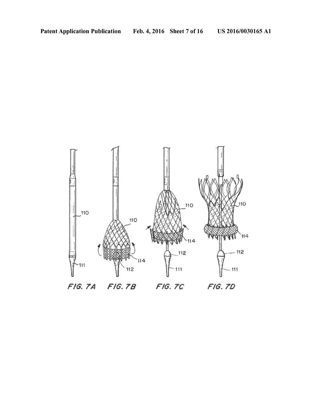 Means for Controlled Sealing of Endovascular Devices - diagram, schematic, and image 08