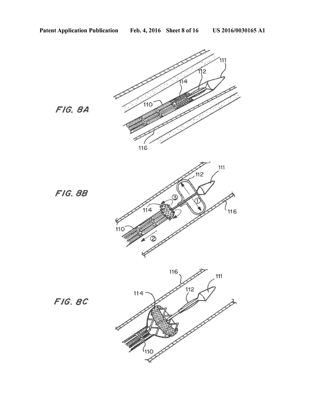 Means for Controlled Sealing of Endovascular Devices - diagram, schematic, and image 09