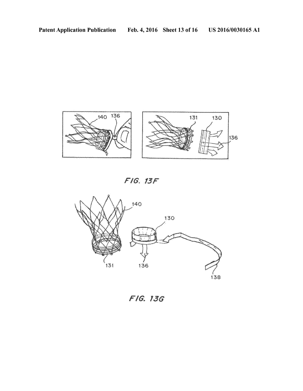 Means for Controlled Sealing of Endovascular Devices - diagram, schematic, and image 14