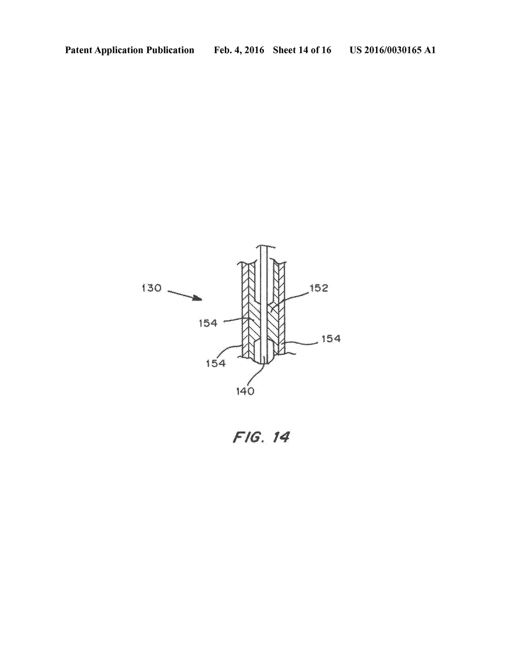 Means for Controlled Sealing of Endovascular Devices - diagram, schematic, and image 15