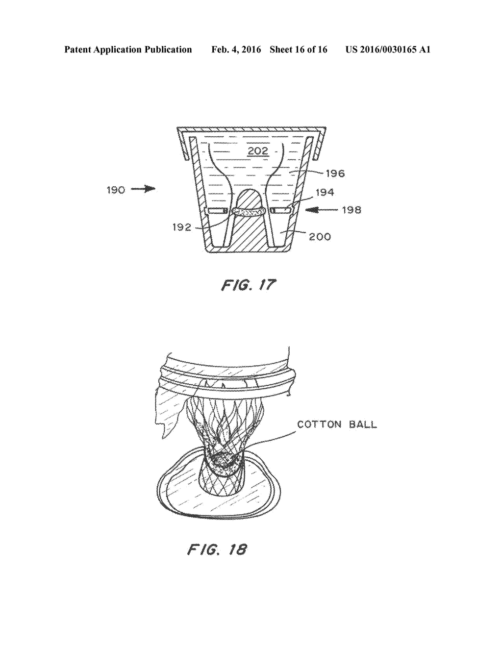 Means for Controlled Sealing of Endovascular Devices - diagram, schematic, and image 17