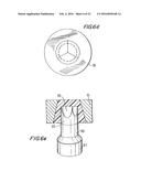 PROSTHETIC HEART VALVE AND METHOD diagram and image